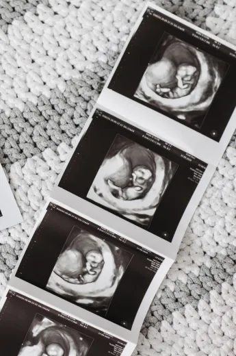 Programme Au coeur de l'in utero